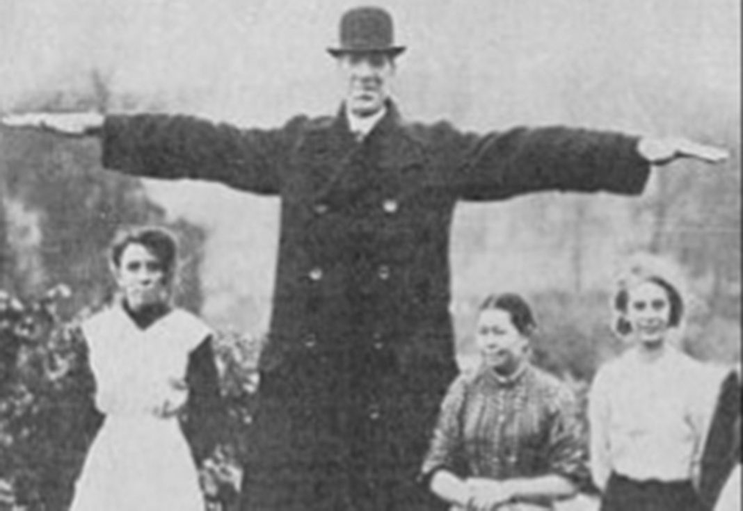 Fred The Giant died in 1918, aged 29.